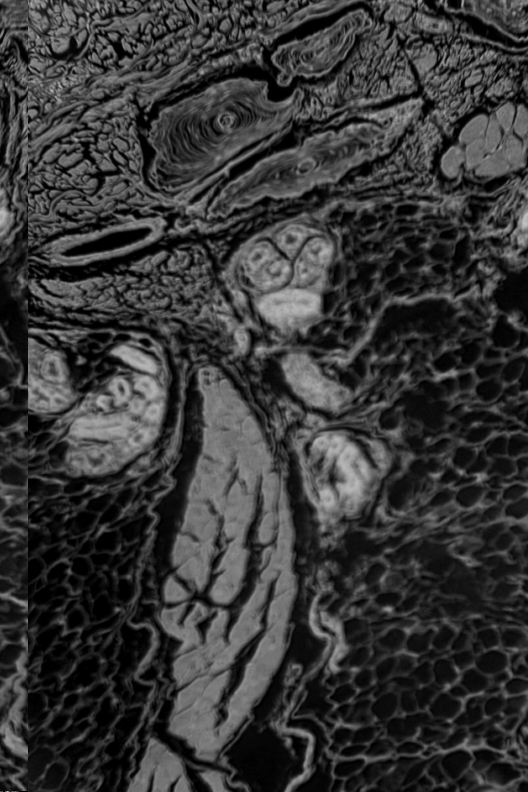 Meissner's corpuscle under microscope