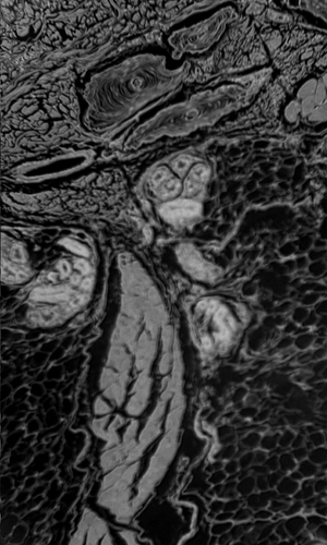 Meissner's corpuscle under microscope