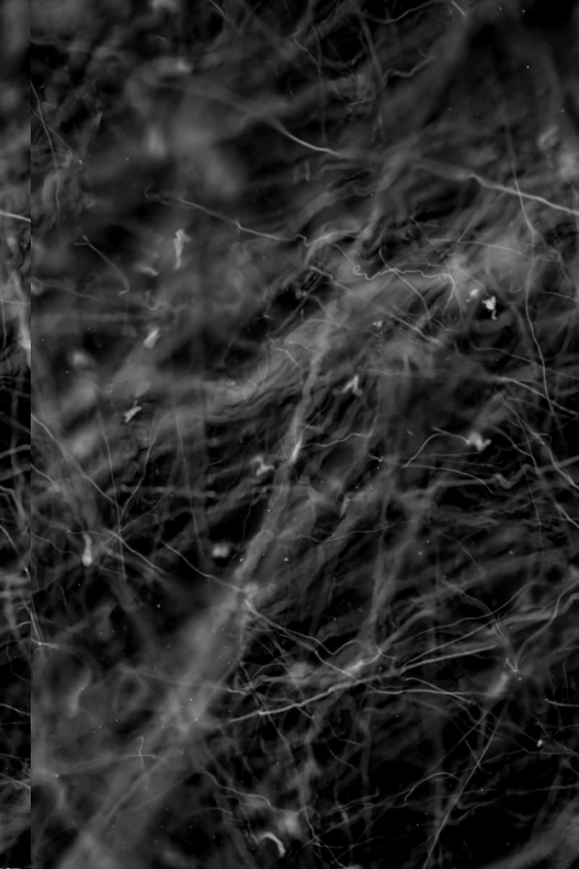 Areolar tissue under microscope