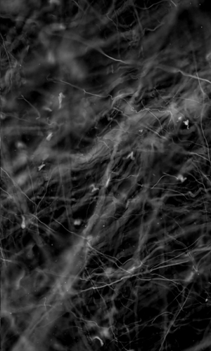 Areolar tissue under microscope