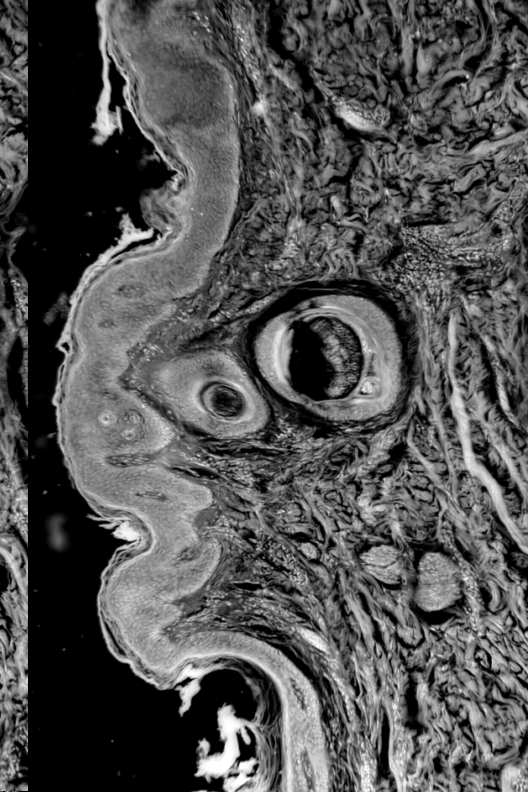 Scalp under microscope