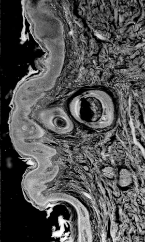 Scalp under microscope