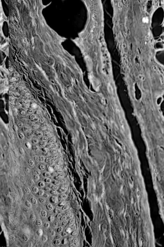 Elastic cartilage under microscope