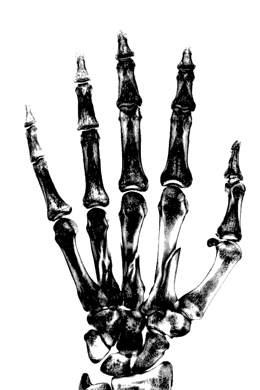 Hand X-Ray