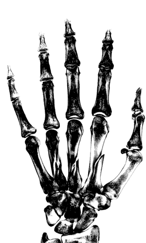 Hand X-Ray